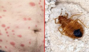 10-Signs-of-Bed-Bugs-to-Never-Ignore